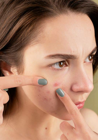 The Ultimate Skincare Solution for You Ladies